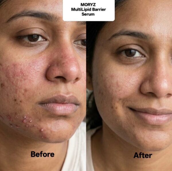 whatsapp image 2026 03 18 at 20.00.05